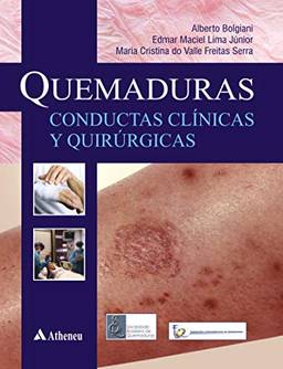 Quemaduras Conductas Clinicas Y Quirurgicas (Spanish Edition)