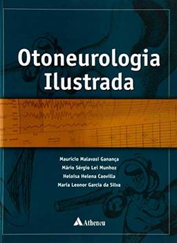 Otoneurologia Ilustrada (Série Otoneurológica)