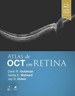 Atlas de OCT em Retina