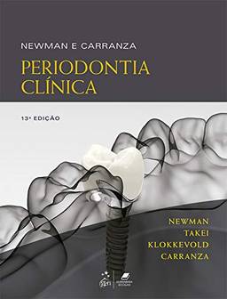 Newman e Carranza: Periodontia Clínica