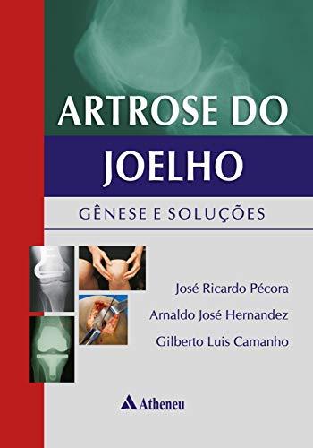 Artrose do Joelho - Gênese e Soluções