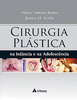 Cirurgia Plástica na Infância e na Adolescência (eBook)