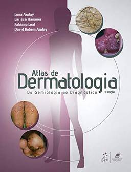 Atlas de Dermatologia: Da Semiologia ao Diagnóstico
