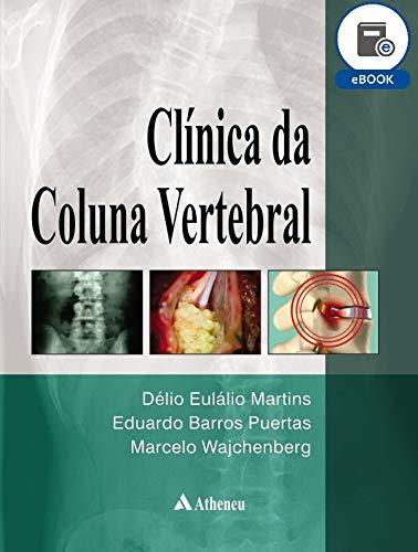 Clínica da Coluna Vertebral (eBook)