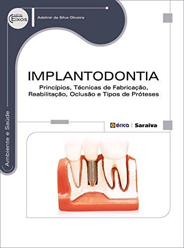 Implantodontia: Princípios, técnicas de fabricação, reabilitação, oclusão e tipos de próteses