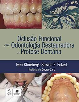 Oclusão Funcional em Odontologia Restauradora e Prótese Dentária