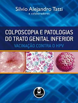 Colposcopia e Patologias do Trato Genital Inferior: Vacinação Contra o HPV