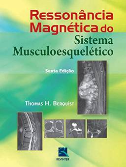 Ressonância Magnética do Sistema Musculoesquéletico