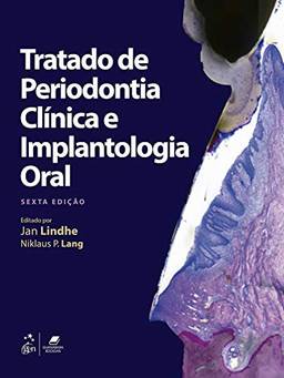 Tratado de Periodontia Clínica e Implantologia Oral