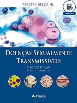 Doenças Sexualmente Transmissíveis - 2ª Edição (eBook)