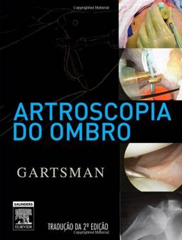 Artroscopia do Ombro (+ DVD)