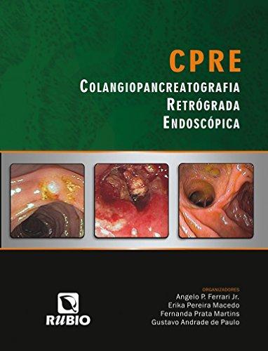 CPRE – Colangiopancreatografia Retrógrada Endoscópica