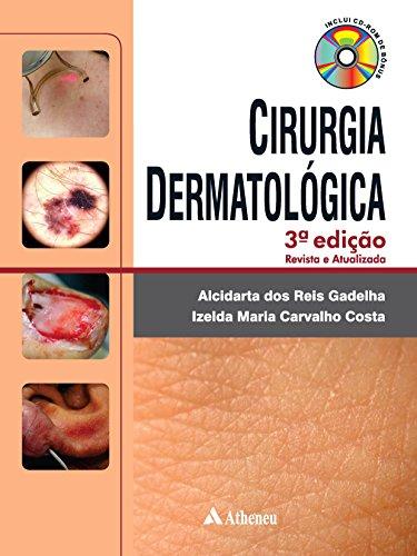 Cirurgia Dermatológica - 3ª Edição