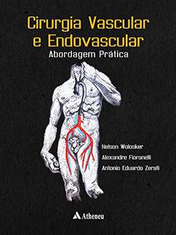Cirurgia Vascular e Endovascular